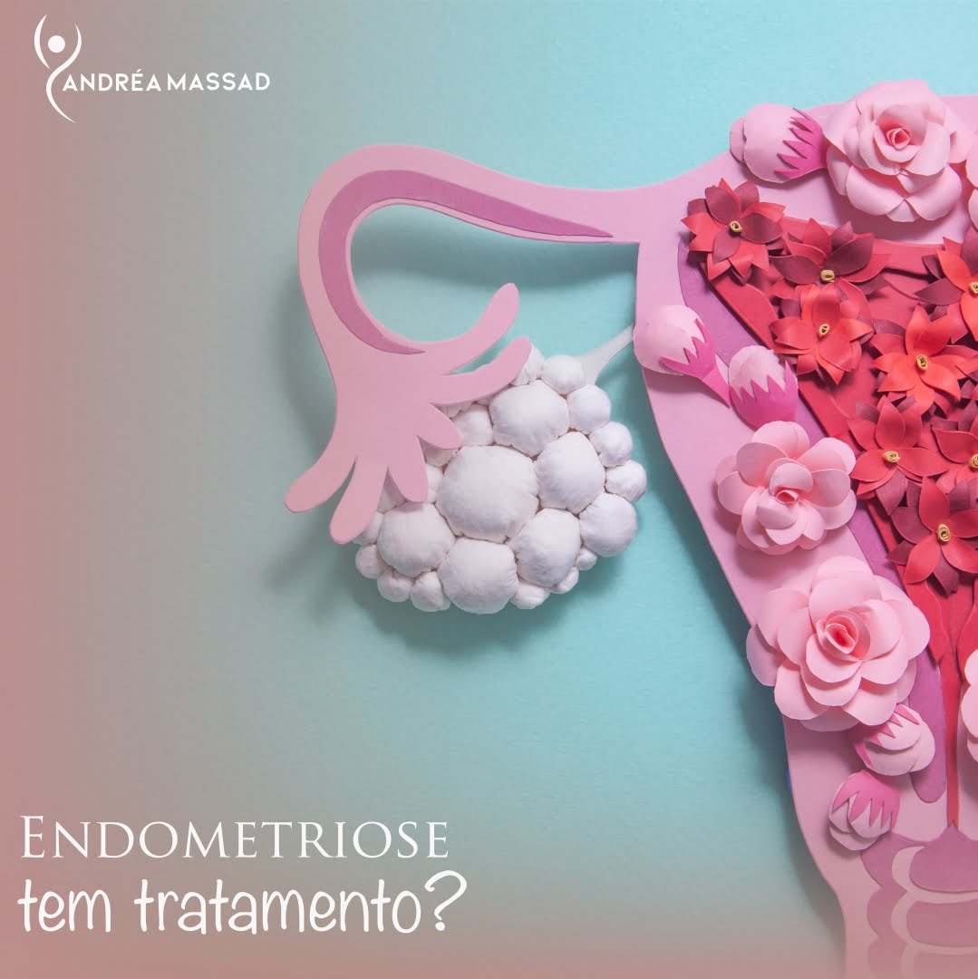 Leia mais sobre o artigo Endometriose tem Tratamento?