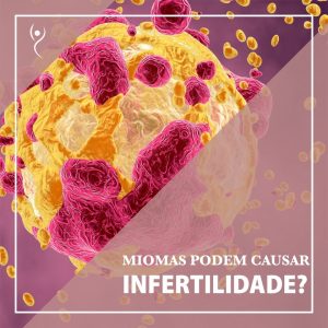 Leia mais sobre o artigo Miomas Podem Causar Infertilidade?