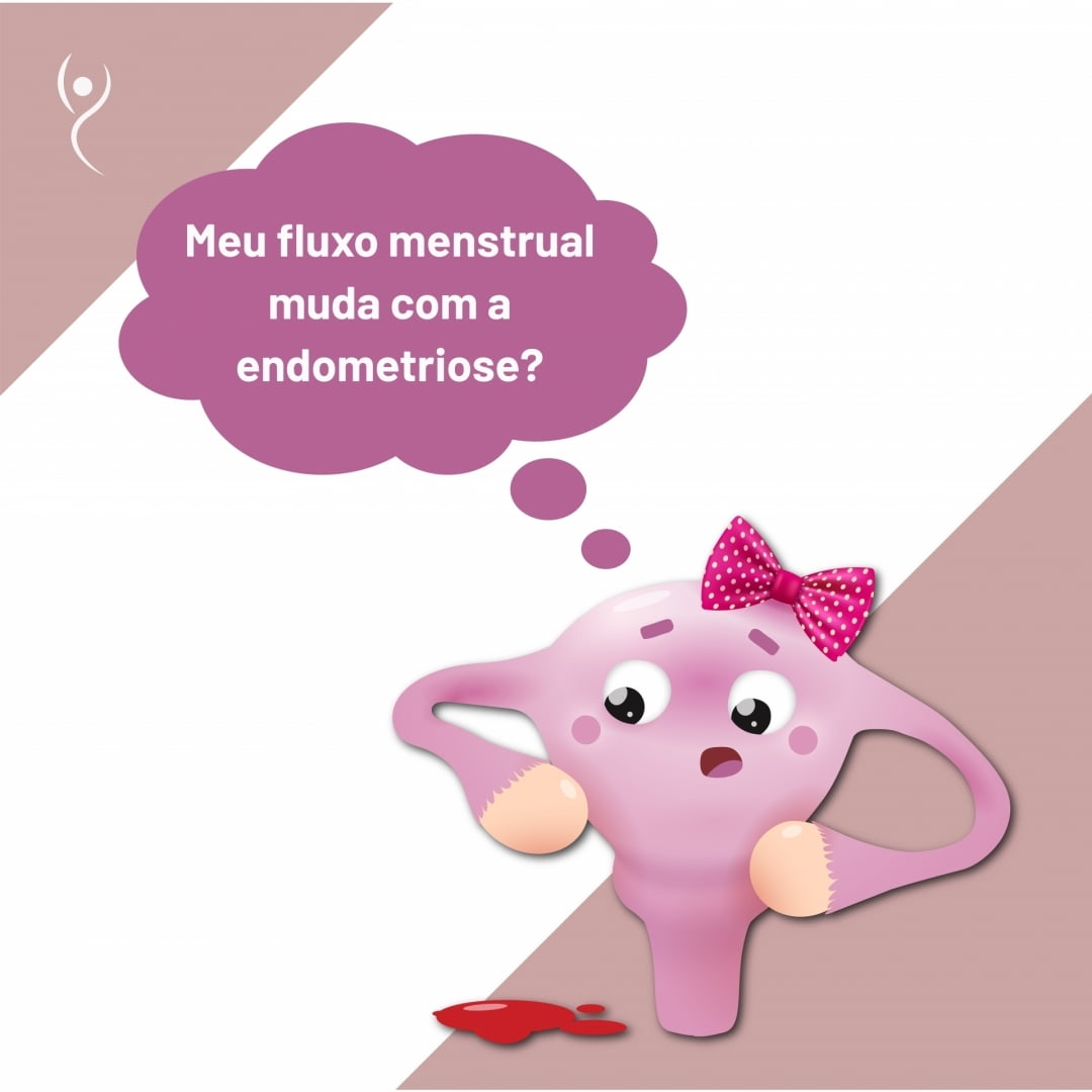 Endometriose e menstruação