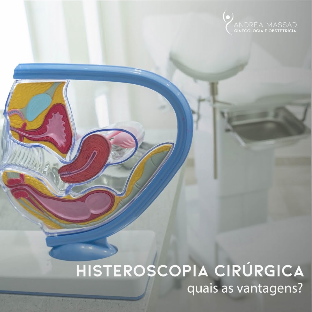 Leia mais sobre o artigo Histeroscopia Cirurgica: Quais as Vantagens?