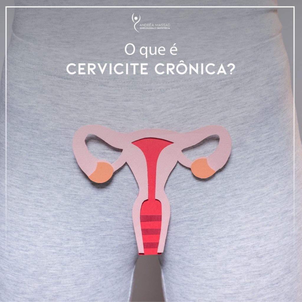 O Que Significa Cervicite Cr Nica Ensino