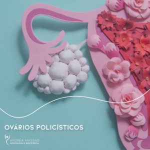 Leia mais sobre o artigo Ovário Policísticos