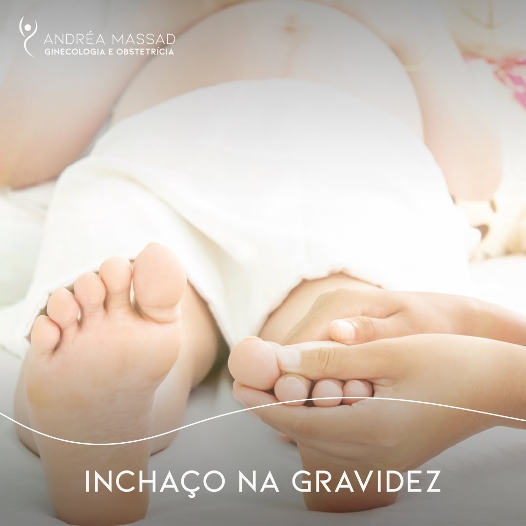 Leia mais sobre o artigo Inchaço na gravidez