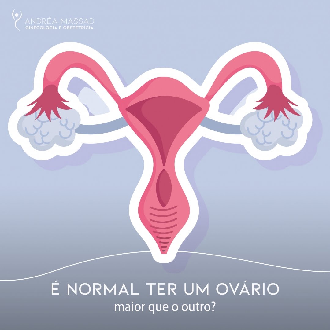 Leia mais sobre o artigo É normal ter um ovário maior que o outro?