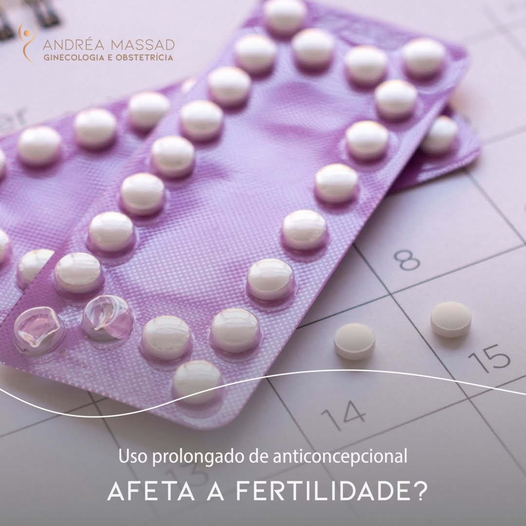Leia mais sobre o artigo Uso prolongado de anticoncepcional afeta a fertilidade?
