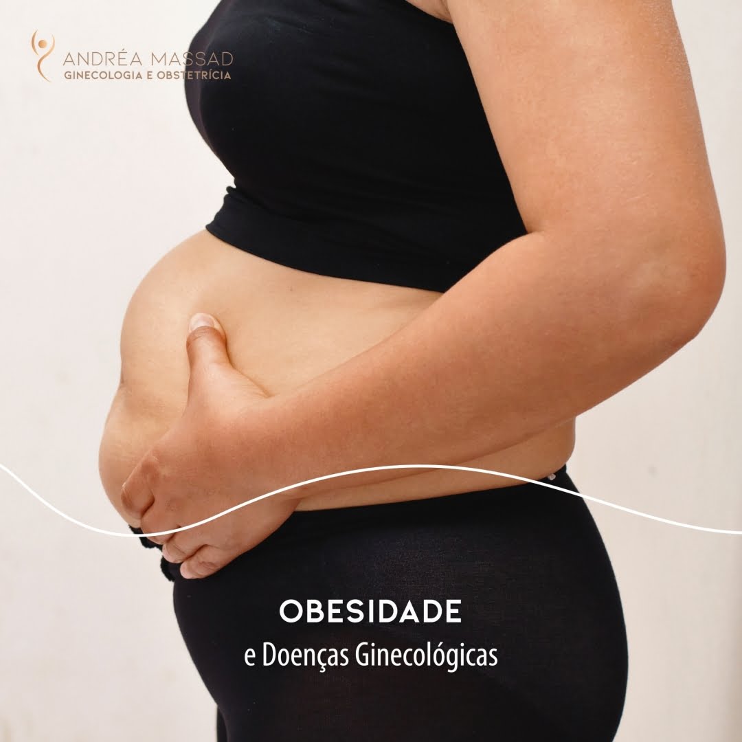 No momento, você está visualizando Obesidade e doenças ginecológicas