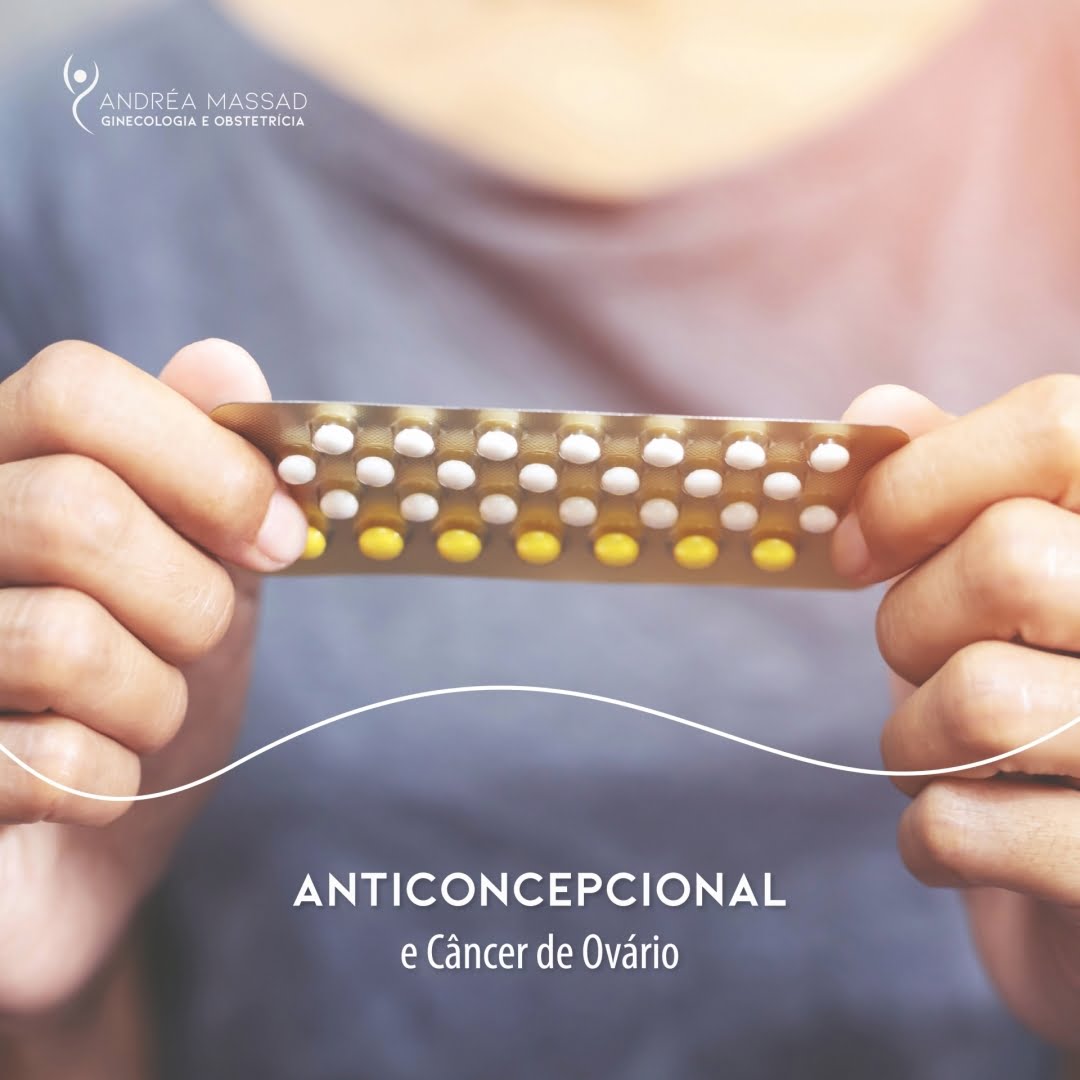Leia mais sobre o artigo Anticoncepcional e câncer de ovário