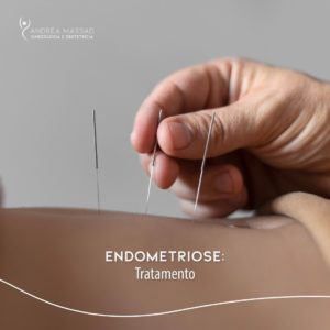 Leia mais sobre o artigo Endometriose: tratamento