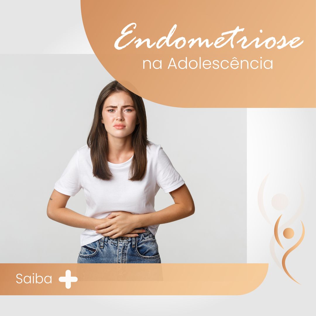 No momento, você está visualizando Endometriose na adolescência