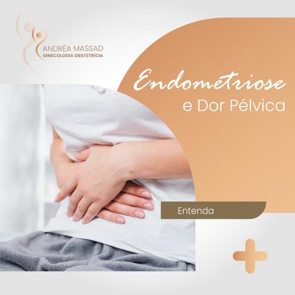 No momento, você está visualizando Endometriose e dor pélvica