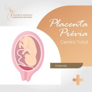 Leia mais sobre o artigo Placenta prévia centro total