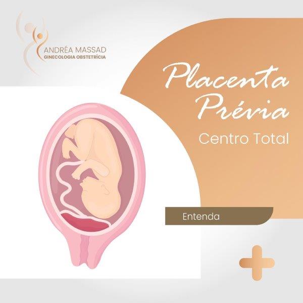 Leia mais sobre o artigo Placenta prévia centro total